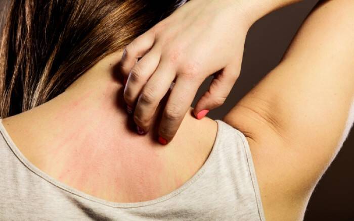 Αλλεργίες: Από ποια σοβαρή πάθηση προστατεύουν