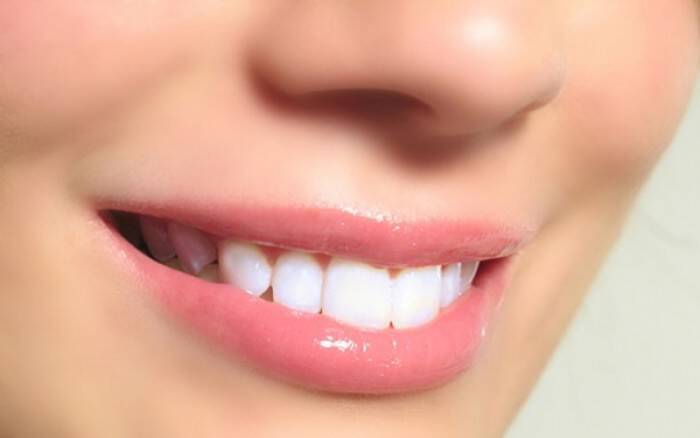 Λευκά δόντια: Με ποιους τρόπους θα τα αποκτήσετε