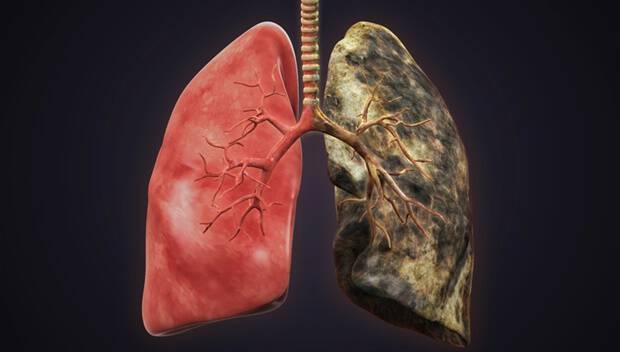 Πώς γίνονται οι πνεύμονες με το κάπνισμα – Μοναδικές ιατρικές εικόνες [pics, vid]