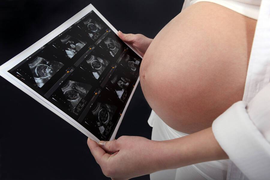 Επιπλοκές στο 1ο τρίμηνο της εγκυμοσύνης: Πώς επηρεάζουν τις μελλοντικές κυήσεις