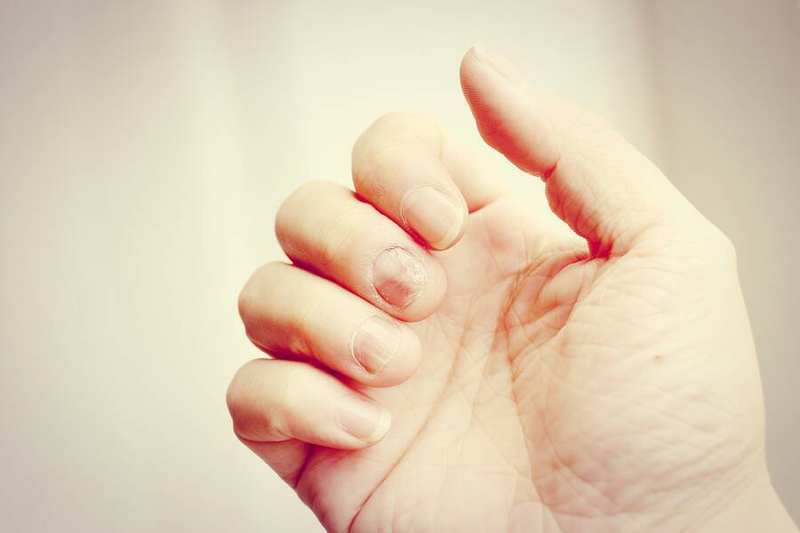 Νύχια που κιτρινίζουν: Αυτές είναι οι 4 βασικές αιτίες