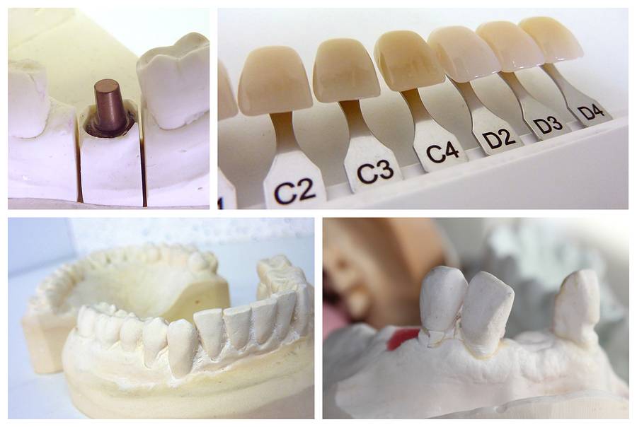 bigstock Dental Technician Objects 9761849